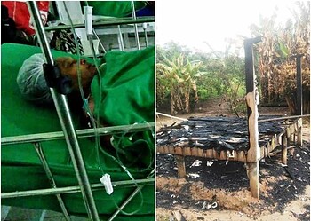 Uso de álcool para cozinhar aumenta casos de queimaduras, afirma Bombeiros