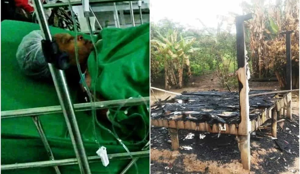Uso de álcool para cozinhar aumenta casos de queimaduras, afirma Bombeiros
