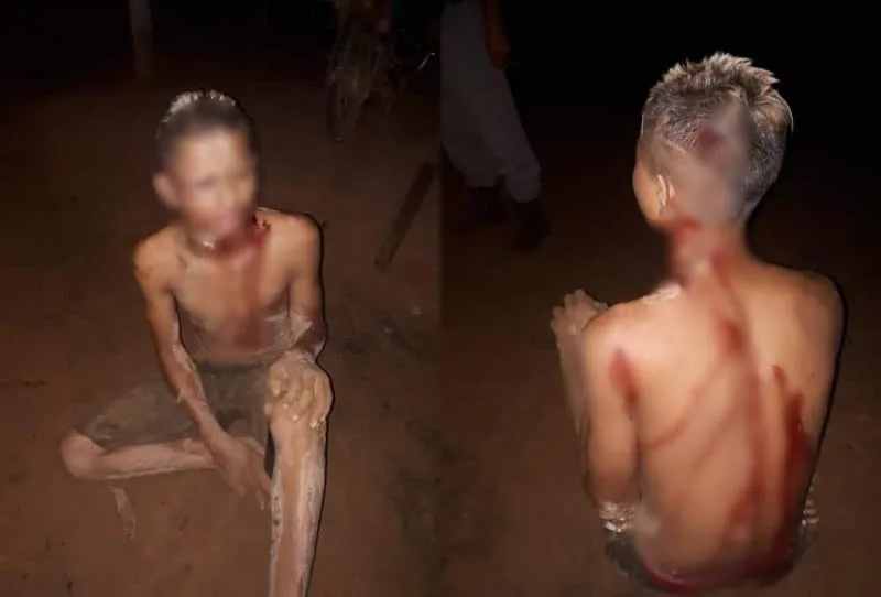 Menor se finge de morto e escapa de ser executado por membros de facção rival