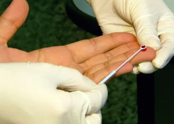 Mais de 115 novos casos de HIV foram registrados em Rio Branco em 2018, aponta levantamento