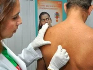 Campanha de dermatologia será realizada na próxima segunda-feira no HC