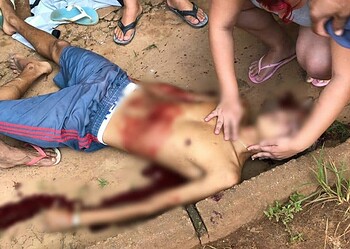 Jovem é levado em estado grave ao Pronto Socorro após ser baleado 12 Jovem é levado em estado grave ao Pronto Socorro após ser baleado