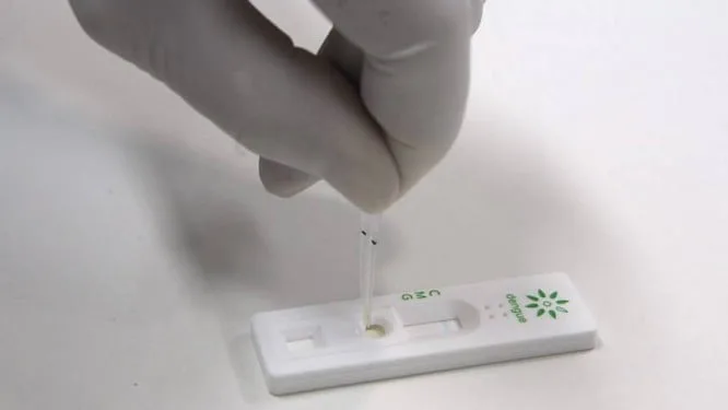 Acre suspende testes rápidos para dengue fornecidos por empresa da Bahia
