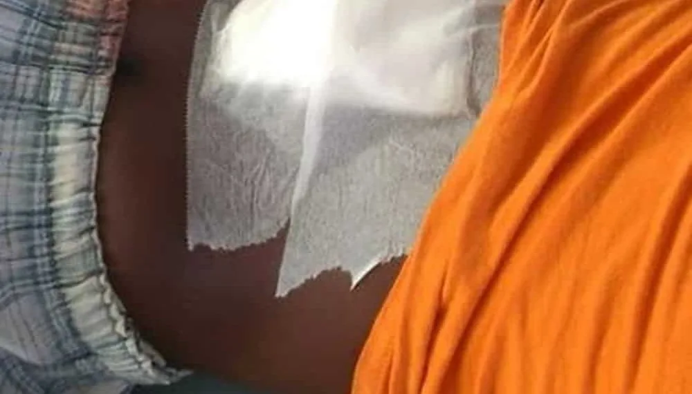 Menino esfaqueia irmão após discussão por causa de estilingue