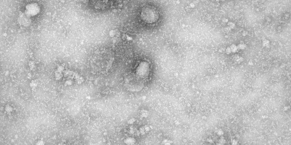 Governo cria grupo para monitorar casos de coronavirus