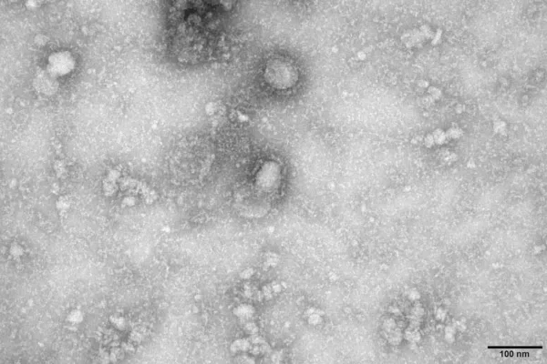Governo cria grupo para monitorar casos de coronavirus