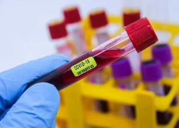 Com mais 84 infectados, Acre soma 817 casos confirmados de covid-19