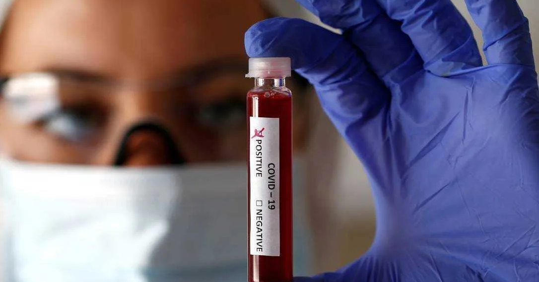 Acre chega a 733 casos do novo coronavírus; taxa de letalidade é de 3,82 no Estado