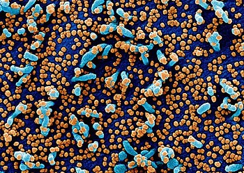 Mulher de 49 anos pode ser a sexta vítima fatal de Covid-19 no Acre