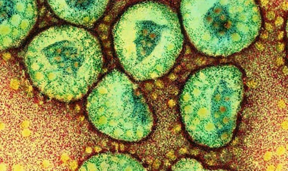 Corona viruses. Coloured transmission electron micrograph of a section through a cluster of corona viruses. The corona viruses (green) cause the common cold and gastroenteritis in humans. The corona virus received its name because of its characteristic setting sun appearance. This is provided by the projections (peplomers) studding the outer membrane of the virus. Beneath the outer membrane of each virus is the protein shell (green) called the capsid. This encloses the nucleoprotein (genetic material). Magnification: x117, 000 at 6x7cm size. x409, 500 at 10x8