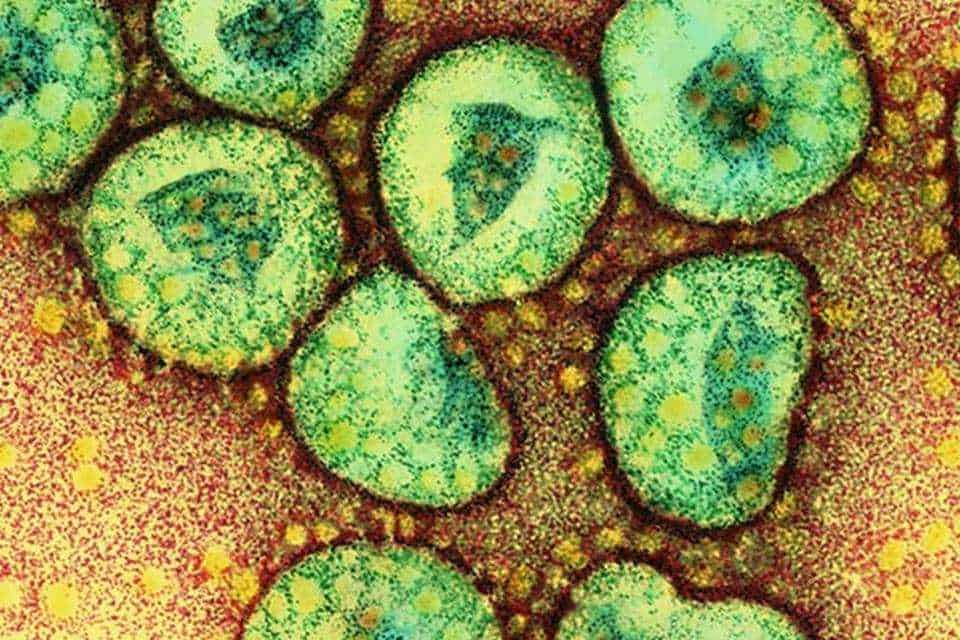 Corona viruses. Coloured transmission electron micrograph of a section through a cluster of corona viruses. The corona viruses (green) cause the common cold and gastroenteritis in humans. The corona virus received its name because of its characteristic setting sun appearance. This is provided by the projections (peplomers) studding the outer membrane of the virus. Beneath the outer membrane of each virus is the protein shell (green) called the capsid. This encloses the nucleoprotein (genetic material). Magnification: x117, 000 at 6x7cm size. x409, 500 at 10x8