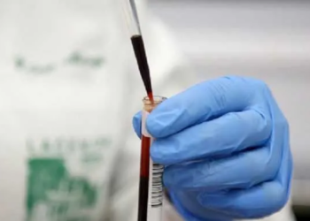 Acre chega a 574 mortes e 22.242 casos confirmados de Covid-19