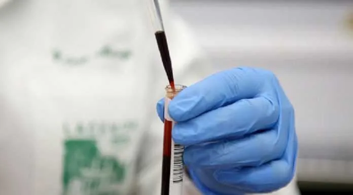 Acre chega a 574 mortes e 22.242 casos confirmados de Covid-19