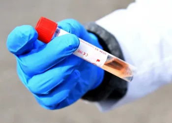 Fiocruz: aumento de casos e óbitos de covid-19 deve servir de alerta