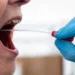 Teste da Unesp identifica assintomáticos de Covid-19 pela saliva