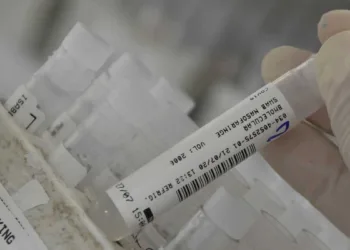 An employee at the Hermes Pardini laboratory shows a sample of the coronavirus disease (COVID-19) testing with PCR amplification, in Vespasiano, near Belo Horizonte, Brazil, July 23, 2020. Picture taken July 23, 2020. REUTERS/Washington Alves