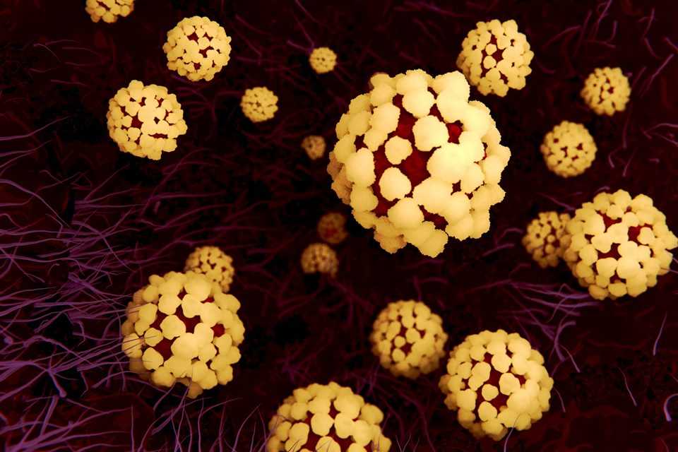 Illustration of coronavirus particles in the lung. Different strains of coronavirus are responsible for diseases such as the common cold, gastroenteritis and SARS (severe acute respiratory syndrome). A new coronavirus (2019-CoV) emerged in Wuhan, China, in December 2019. The virus causes a mild respiratory illness that can develop into pneumonia and be fatal in some cases. The coronaviruses take their name from their crown (corona) of surface proteins, which are used to attach and penetrate their host cells. Once inside the cells, the particles use the cells' machinery to make more copies of the virus.