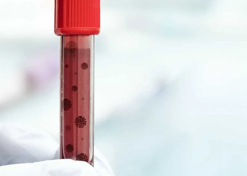 Saúde confirma 68 casos da variante gama no Acre