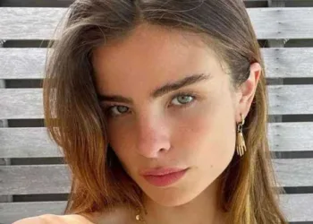 Giulia Be revela detalhes de seu acidente doméstico: “Fraturei parte do crânio”