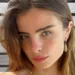 Giulia Be revela detalhes de seu acidente doméstico: “Fraturei parte do crânio”