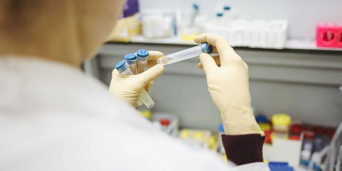 Lacen recebe reagentes e inicia análise de quase 1.300 exames de RT-PCR represados