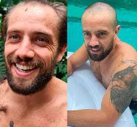 Rafael Cardoso surge careca após ter cabelo raspado pela sogra
