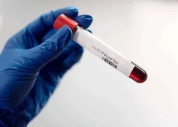 Covid-19: Acre registra mais de 700 novos casos da doença no mês de dezembro