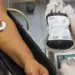 Doação de sangue fortalece cirurgias e apoia rede de saúde do Acre