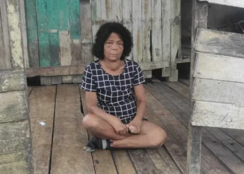 dona luzia hanseníase ajuda