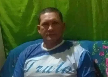 Marcos Oliveira Gil hidrocele