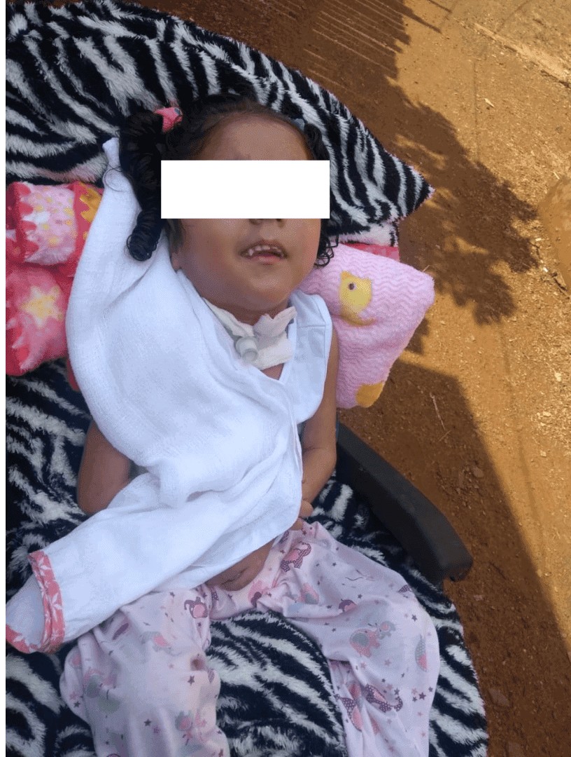 Vivendo em condições insalubres, mãe de menina com paralisia cerebral faz apelo para conseguir casa própria