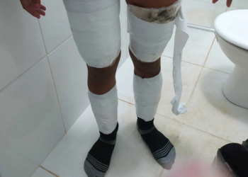 Mulher é presa pela PRF levando drogas na roupa