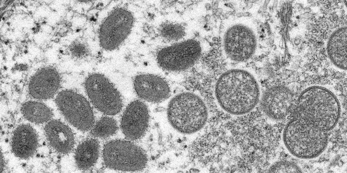 Fiocruz conclui sequenciamento genético do vírus Monkeypox