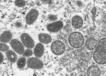 Fiocruz conclui sequenciamento genético do vírus Monkeypox