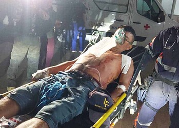 Com a força dos golpes, o homem teve uma costela quebrada e o pulmão perfurado (Foto: Cedida)