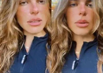 Após ser atacada por cachorros, Mariana Goldfarb se pronuncia: A culpa é de quem deixou a porta aberta