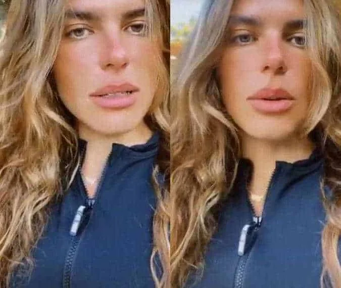 Após ser atacada por cachorros, Mariana Goldfarb se pronuncia: A culpa é de quem deixou a porta aberta