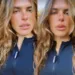 Após ser atacada por cachorros, Mariana Goldfarb se pronuncia: A culpa é de quem deixou a porta aberta