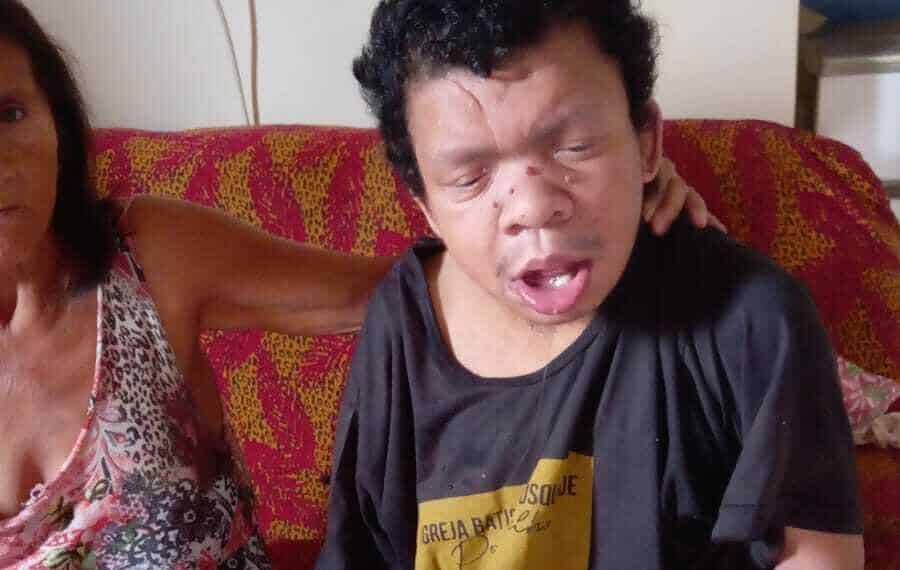 O irmão de Samara, José Vanis Souza, tem 33 anos e possui retardo mental grave, como sequela de paralisia infantil (Foto: Arquivo da família)