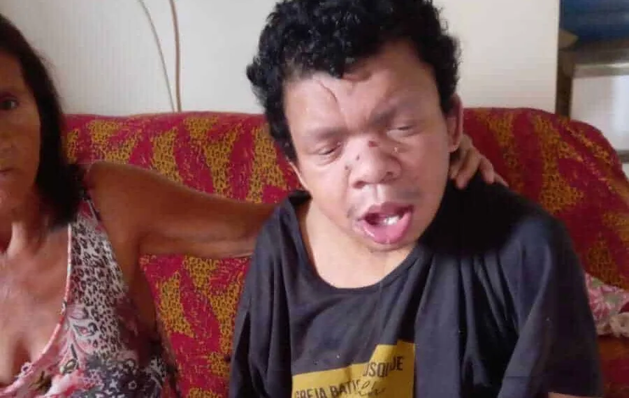 O irmão de Samara, José Vanis Souza, tem 33 anos e possui retardo mental grave, como sequela de paralisia infantil (Foto: Arquivo da família)