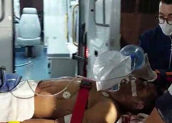 Homem leva tiro na cabeça e dupla de criminosos foge