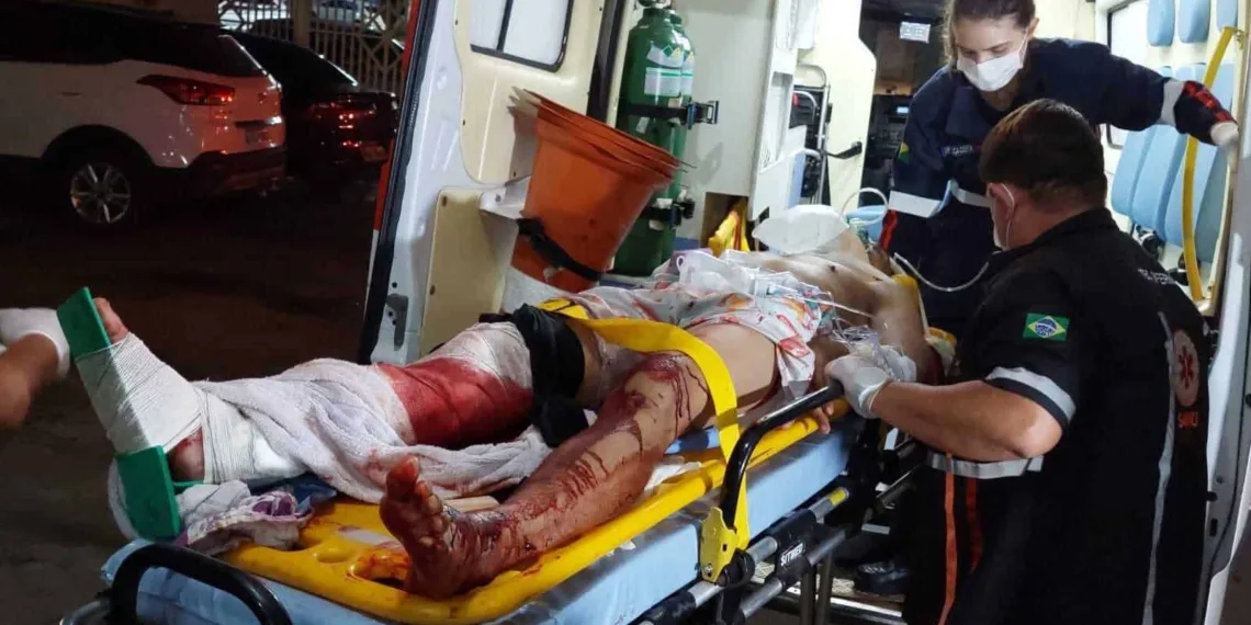 Colisão entre moto e trator deixa vítimas com perna dilacerada e múltiplas fraturas na BR 317