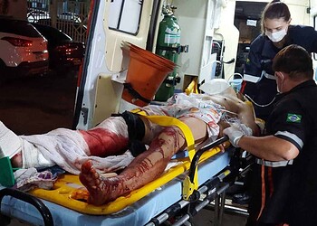 Colisão entre moto e trator deixa vítimas com perna dilacerada e múltiplas fraturas na BR 317