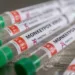 Saúde Ministro diz que Brasil terá antiviral para tratar varíola dos macacos