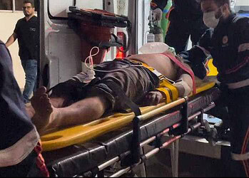 Motociclista perde o controle, colide contra muro e fica em estado grave