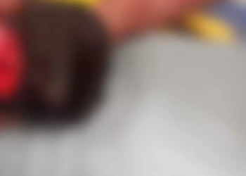 Homem é ferido com golpe de foice na cabeça após se envolver em discussão com patrão, no interior do Acre