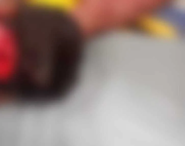 Homem é ferido com golpe de foice na cabeça após se envolver em discussão com patrão, no interior do Acre