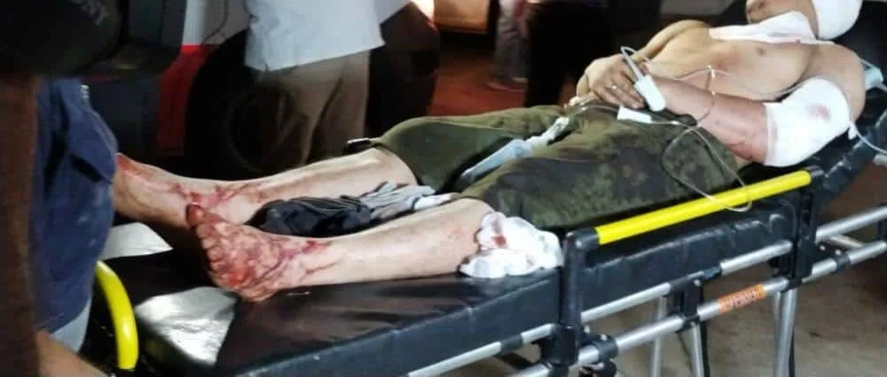 Jovem de 25 anos é ferido a golpes de terçado durnate briga entre familiares em Rio Branco, após partida de futebol