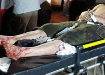 Jovem de 25 anos é ferido a golpes de terçado durnate briga entre familiares em Rio Branco, após partida de futebol