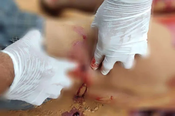 Homem é executado com vários tiros por dupla de facção rival, na região de fronteira